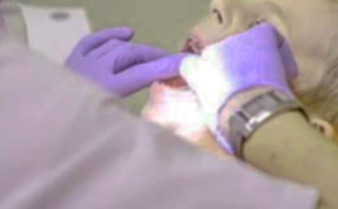 第一次拔牙作文500字